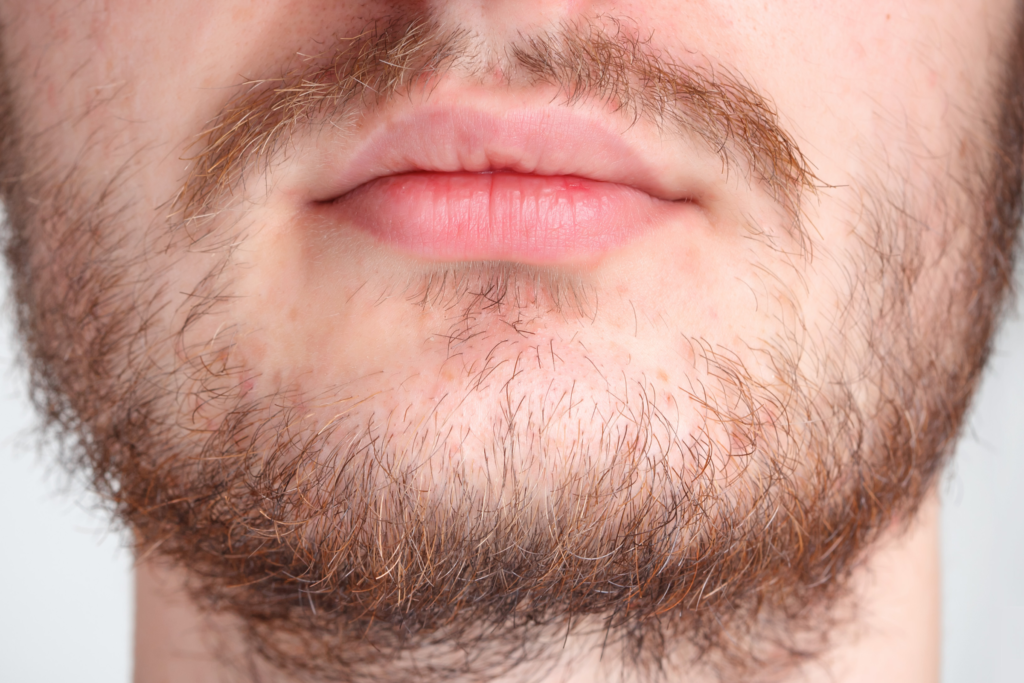 embracing a gap between your mustache and beard